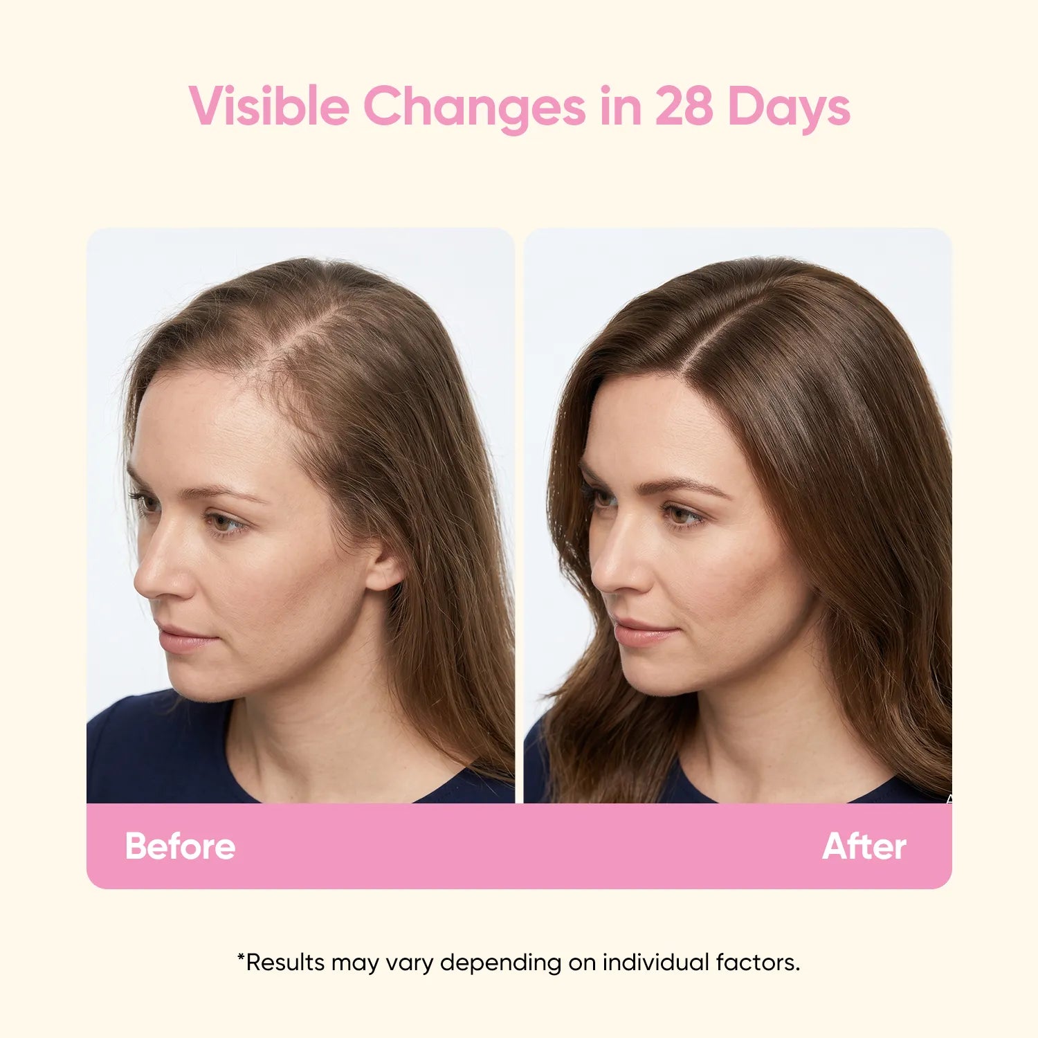 Postnatal Hair Nutrition